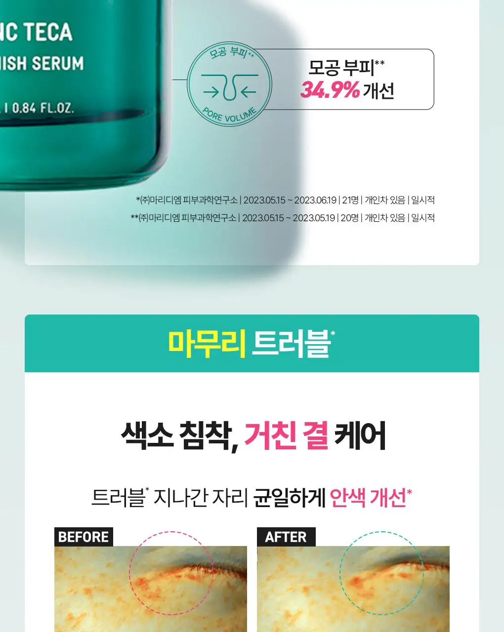 [7월올영픽/3일진정세럼]브링그린 징크테카 트러블 세럼 대용량 기획 상세페이지 32